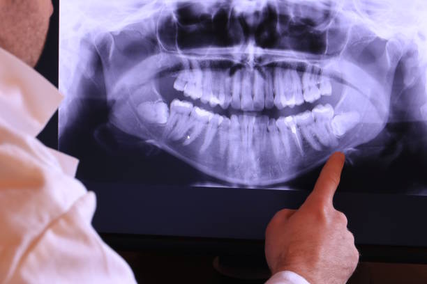 Best Emergency Treatment for Toothache in Bensenvle, IL